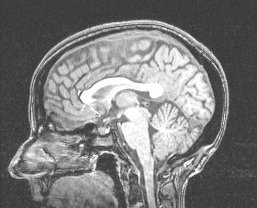 image from an mri